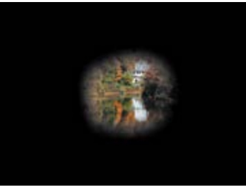 Glaucoma